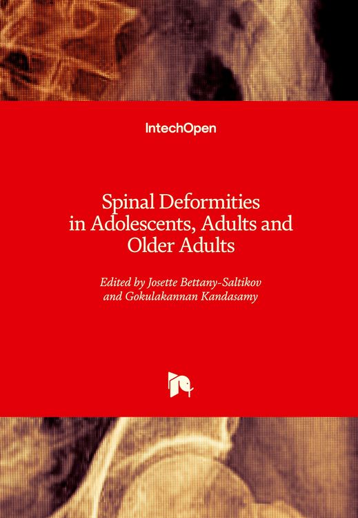 Produktbild: Spinal Deformities in Adolescents, Adults and Older Adults