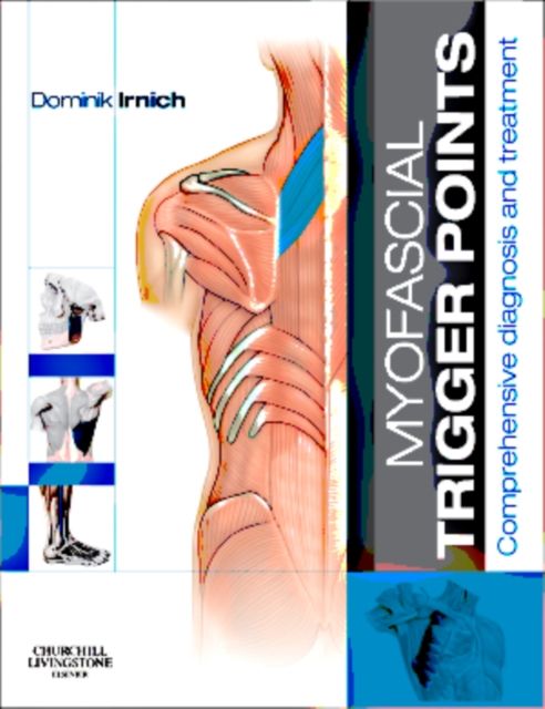 Produktbild: Irnich, D: Myofascial Trigger Points