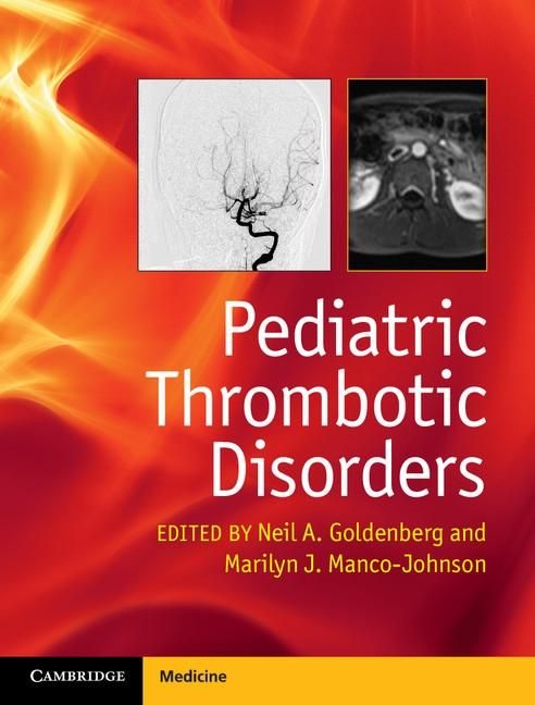 Produktbild: Pediatric Thrombotic Disorders