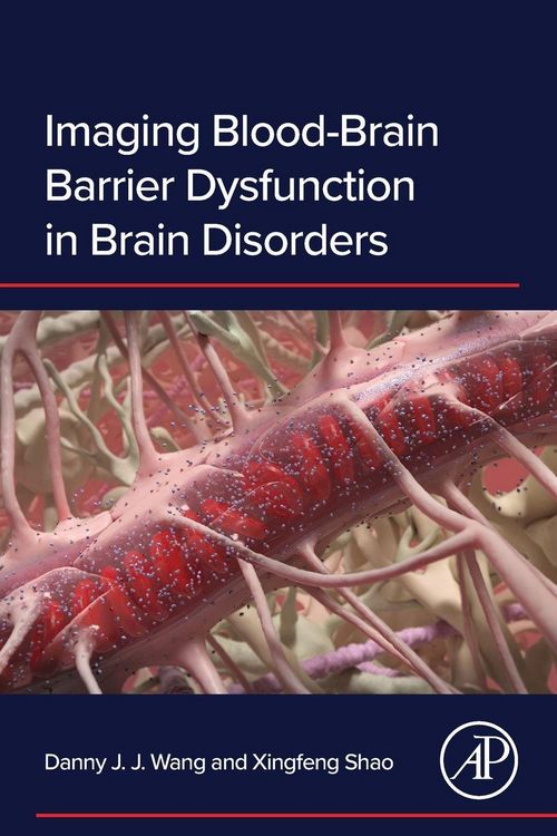 Produktbild: Wang, D: Imaging Blood-Brain Barrier Dysfunction in Brain Di