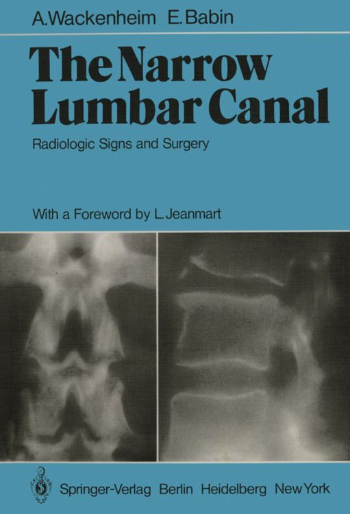 Produktbild: The Narrow Lumbar Canal