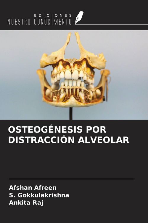 Produktbild: Osteog&eacute;nesis Por Distracci&oacute;n Alveolar
