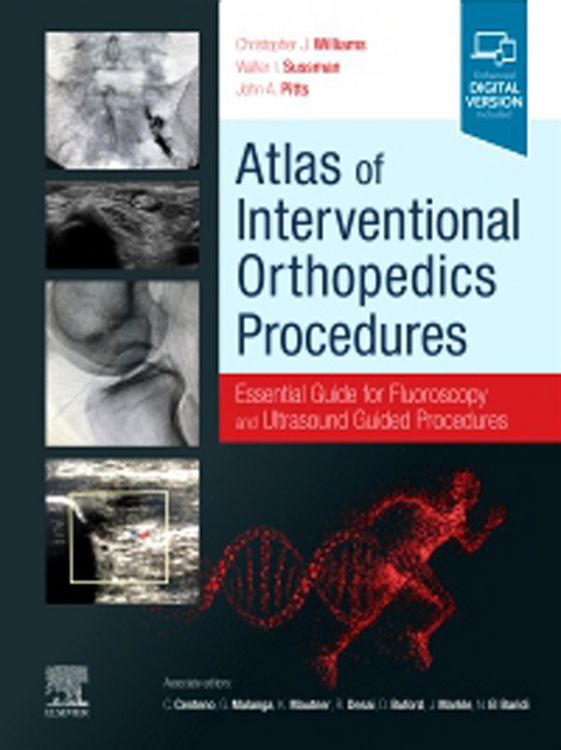 Produktbild: Atlas of Interventional Orthopedics Procedures, E-Book