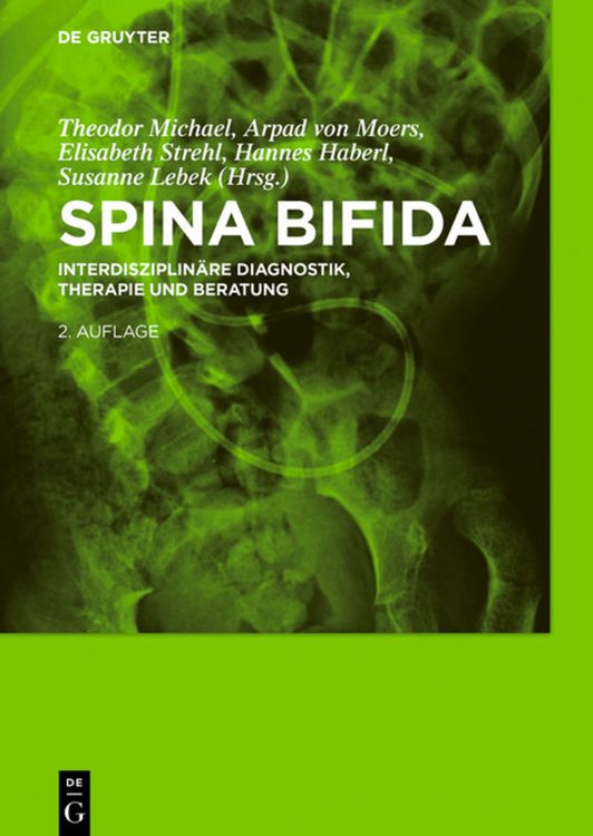Produktbild: Spina bifida