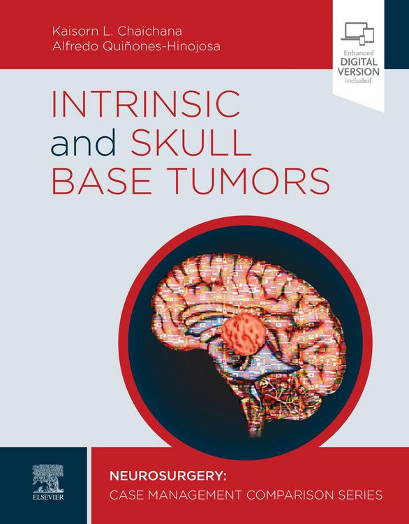 Produktbild: Intrinsic and Skull Base Tumors - E-Book