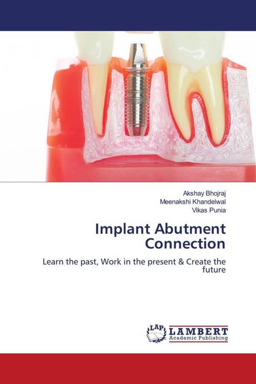 Produktbild: Implant Abutment Connection