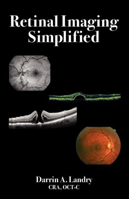 Produktbild: Retinal Imaging Simplified