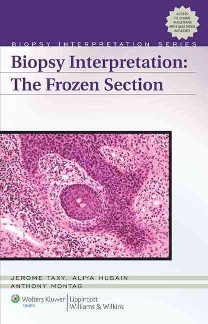 Produktbild: Biopsy Interpretation: The Frozen Section [With Access Code]