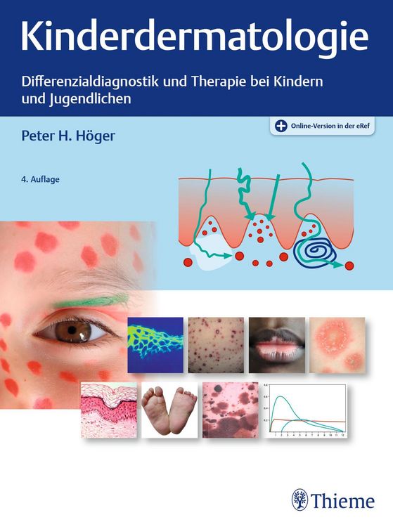Produktbild: Kinderdermatologie