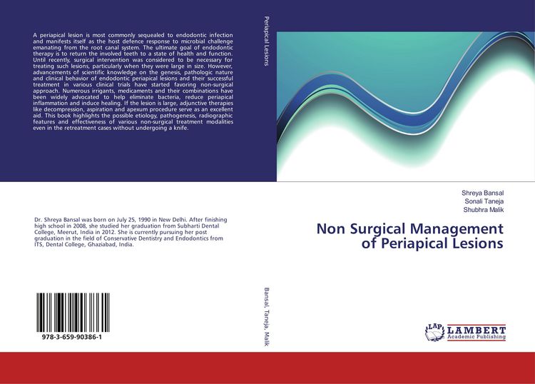 Produktbild: Non Surgical Management of Periapical Lesions