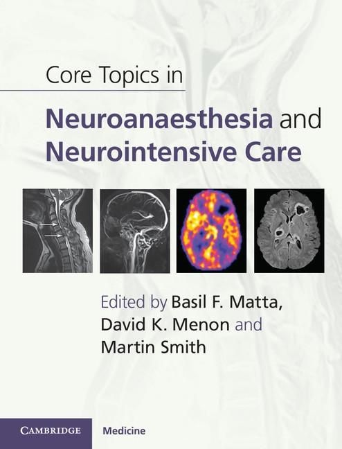 Produktbild: Core Topics in Neuroanaesthesia and Neurointensive Care