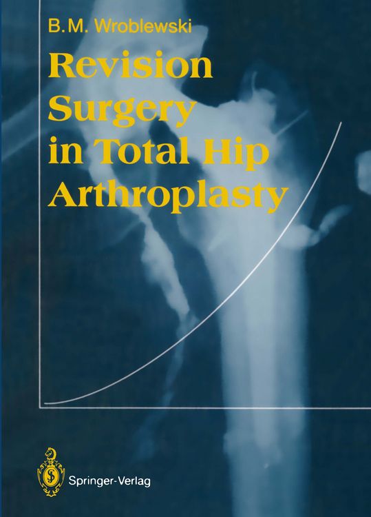 Produktbild: Revision Surgery in Total Hip Arthroplasty