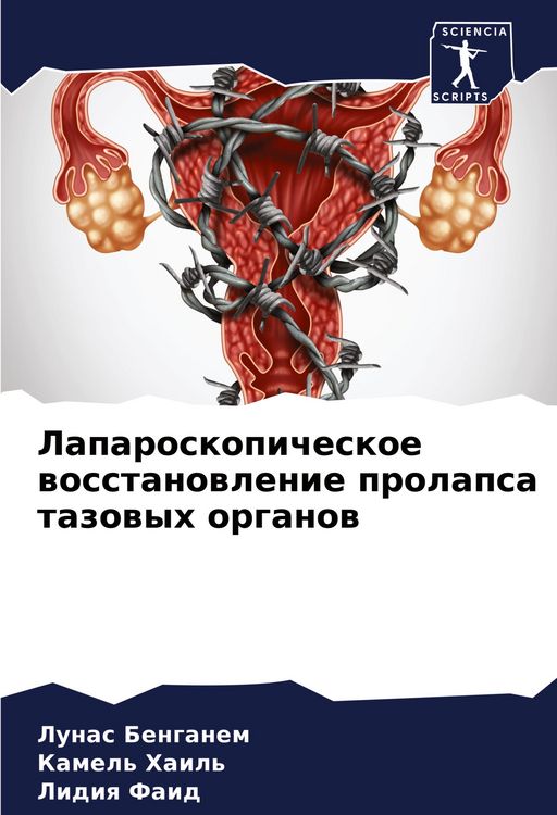 Produktbild: Laparoskopicheskoe wosstanowlenie prolapsa tazowyh organow