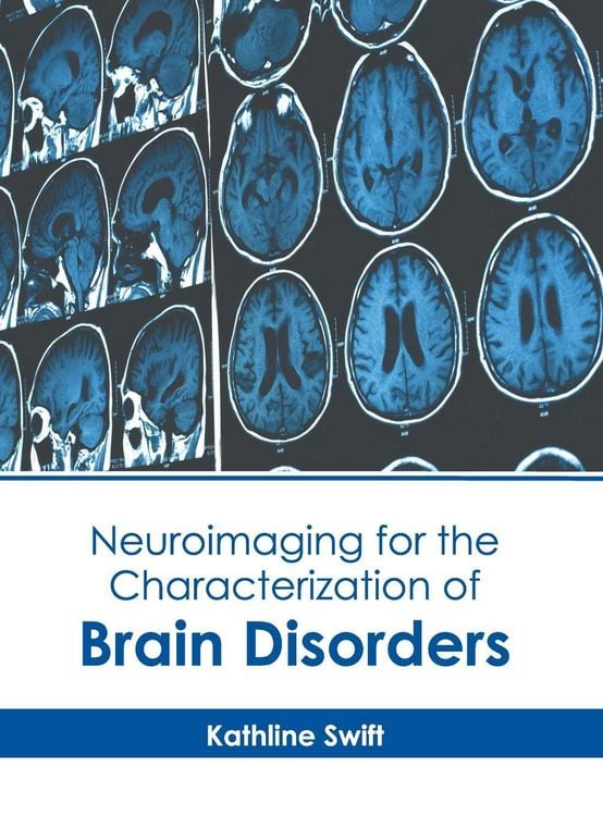 Produktbild: Neuroimaging for the Characterization of Brain Disorders