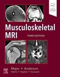 Produktbild: Musculoskeletal MRI