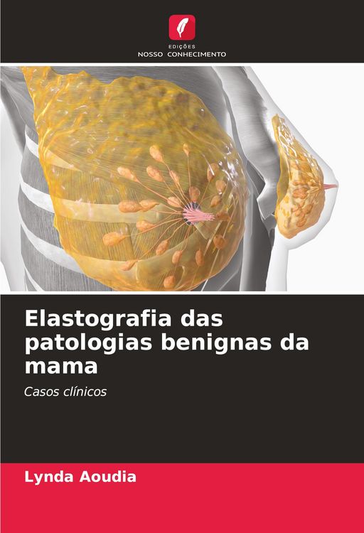 Produktbild: Elastografia das patologias benignas da mama