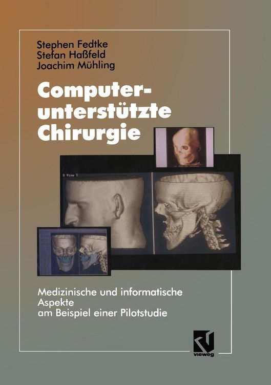 Produktbild: Computerunterst&uuml;tzte Chirurgie