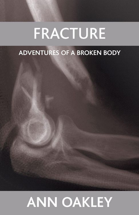 Produktbild: Fracture
