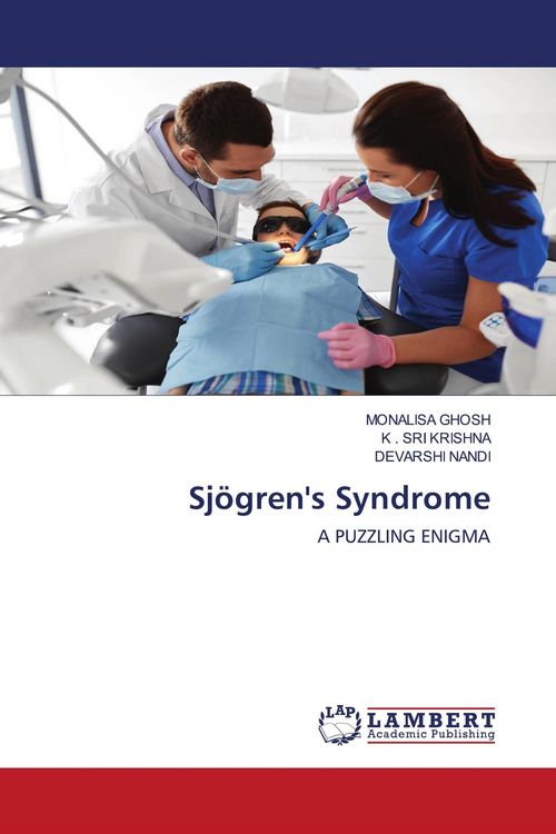 Produktbild: Sj&ouml;gren's Syndrome