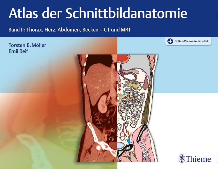 Produktbild: Atlas der Schnittbildanatomie