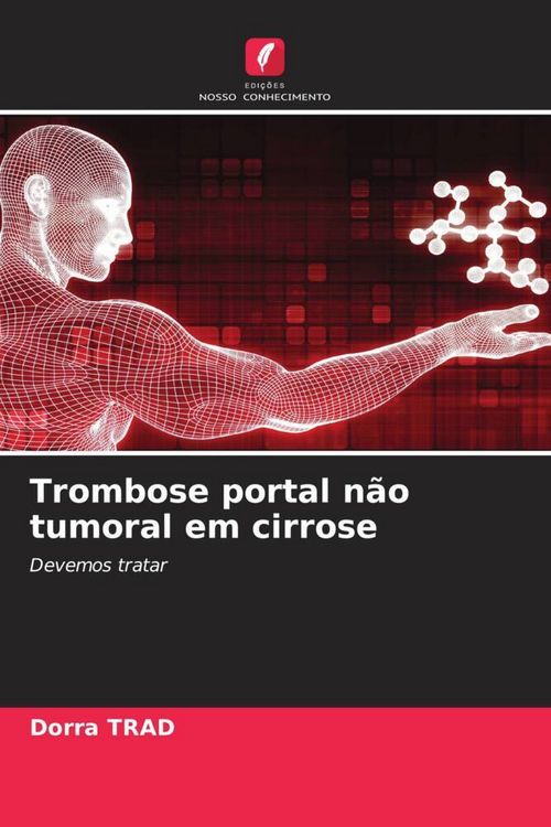 Produktbild: Trombose portal n&atilde;o tumoral em cirrose