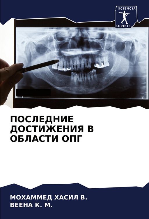 Produktbild: Poslednie Dostizheniya V Oblasti Opg