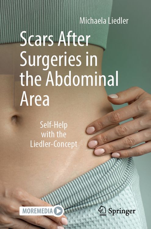 Produktbild: Scars After Surgeries in the Abdominal Area