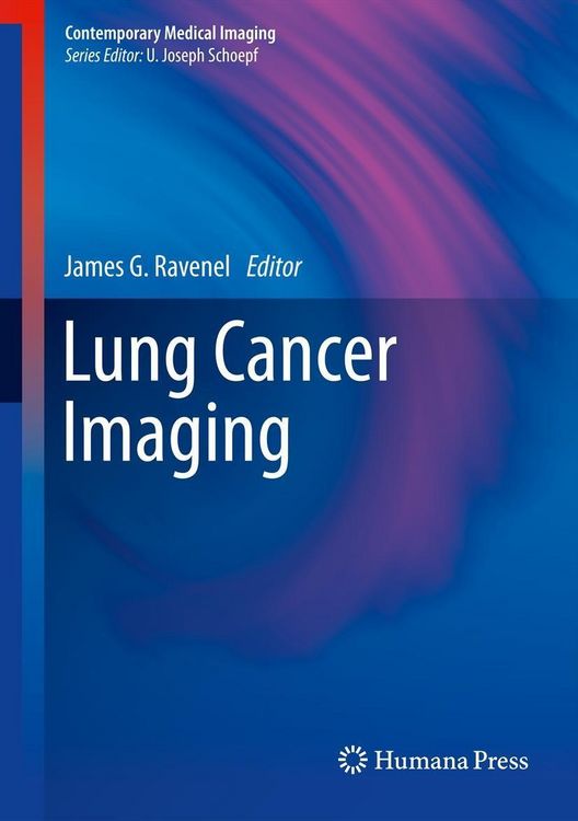 Produktbild: Lung Cancer Imaging