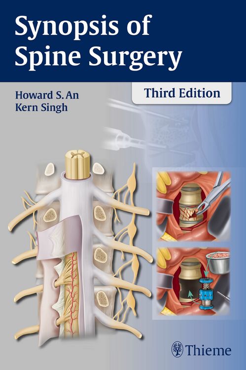 Produktbild: Synopsis of Spine Surgery