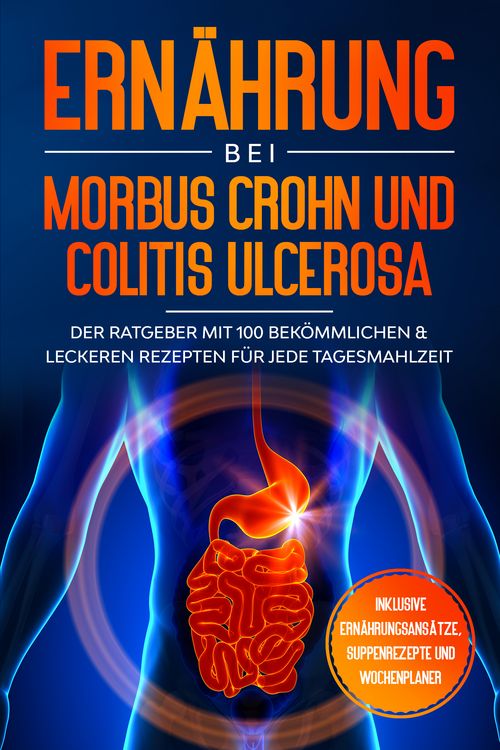 Produktbild: Ern&auml;hrung bei Morbus Crohn und Colitis Ulcerosa: Der Ratgeber mit 100 bek&ouml;mmlichen & leckeren Rezepten f&uuml;r jede Tagesmahlzeit - Inklusive Ern&auml;hrungsans&auml;tze, Suppenrezepte und Wochenplaner