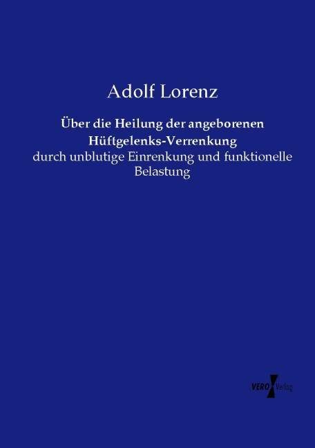Produktbild: &Uuml;ber die Heilung der angeborenen H&uuml;ftgelenks-Verrenkung