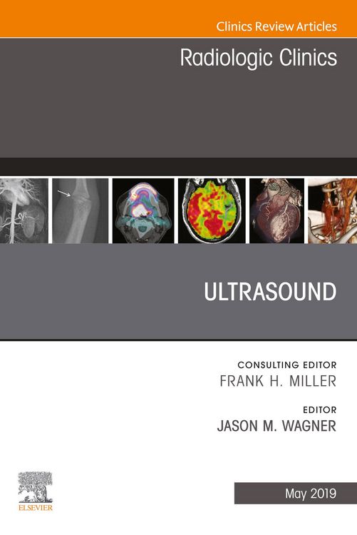 Produktbild: Ultrasound, An Issue of Radiologic Clinics of North America