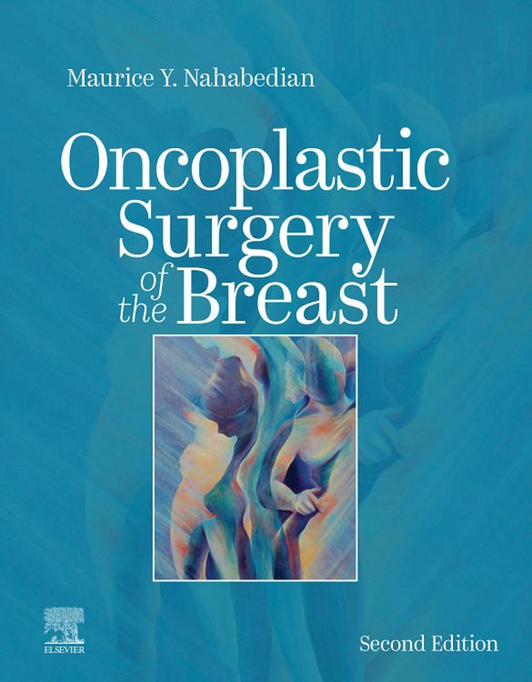 Produktbild: Oncoplastic Surgery of the Breast E-Book