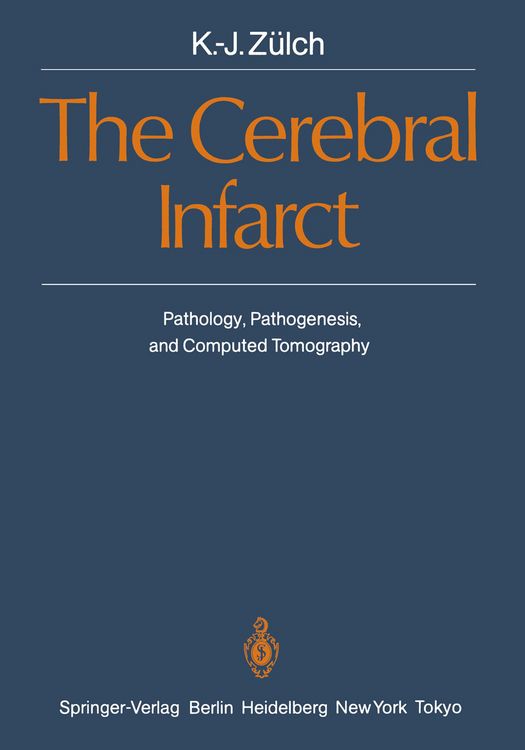 Produktbild: The Cerebral Infarct