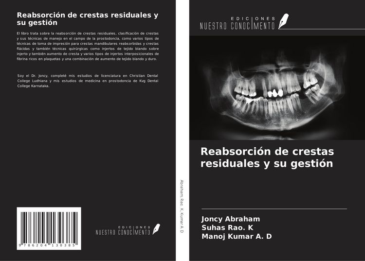 Produktbild: Reabsorci&oacute;n de crestas residuales y su gesti&oacute;n