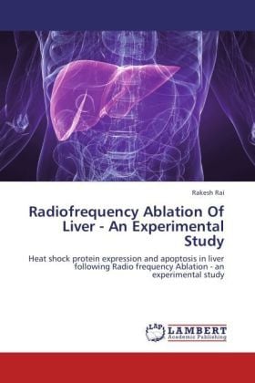 Produktbild: Rai, R: Radiofrequency Ablation Of Liver - An Experimental S