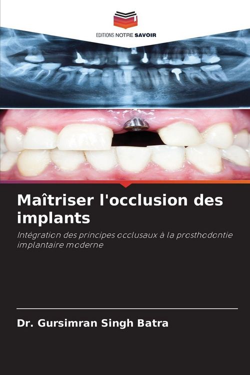 Produktbild: Ma&icirc;triser l'occlusion des implants