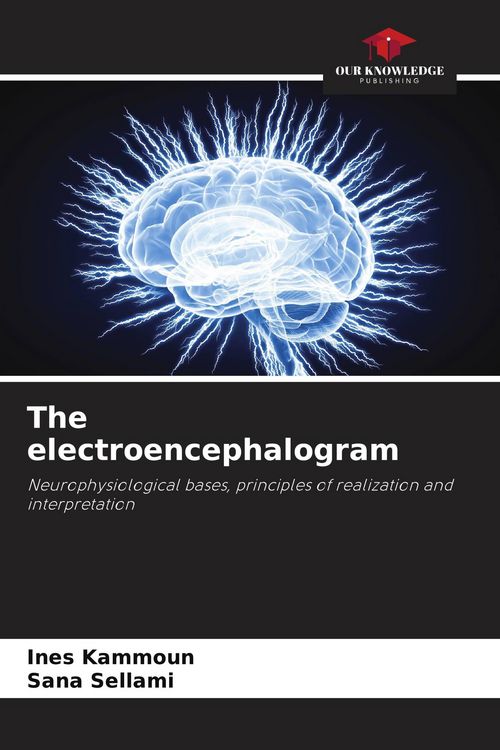 Produktbild: The electroencephalogram