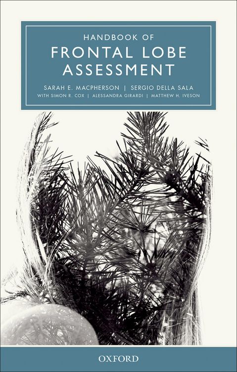 Produktbild: Handbook of Frontal Lobe Assessment