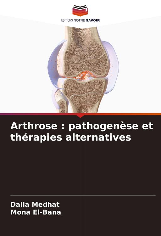 Produktbild: Arthrose : pathogen&egrave;se et th&eacute;rapies alternatives