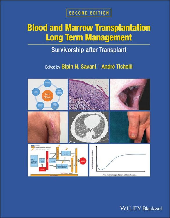 Produktbild: Blood and Marrow Transplantation Long Term Management