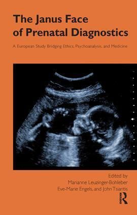 Produktbild: Engels, E: The Janus Face of Prenatal Diagnostics