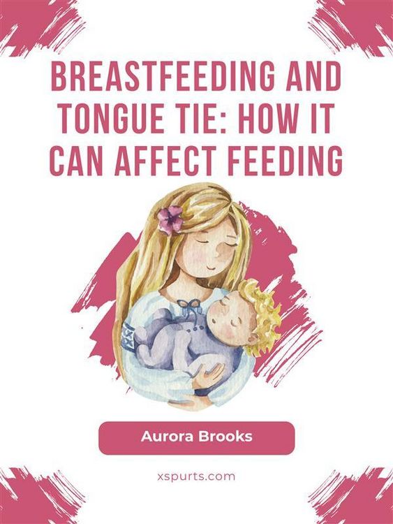 Produktbild: Breastfeeding and tongue tie: How it can affect feeding