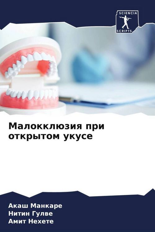 Produktbild: Malokkl&uuml;ziq pri otkrytom ukuse