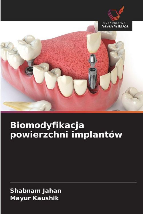 Produktbild: Biomodyfikacja powierzchni implant&oacute;w