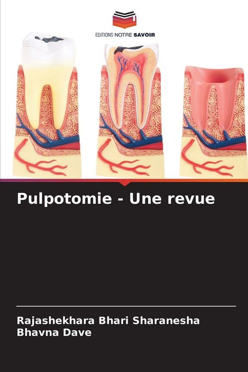 Produktbild: Pulpotomie - Une revue