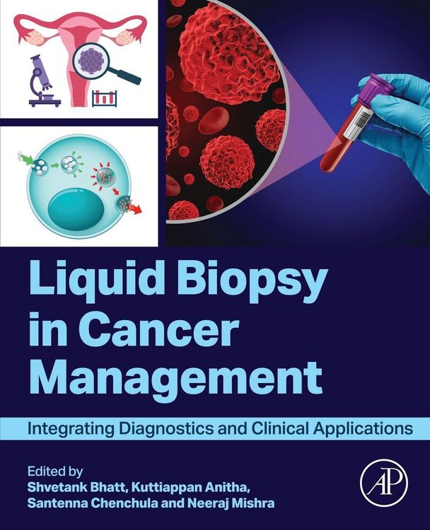 Produktbild: Liquid biopsy in Cancer Management