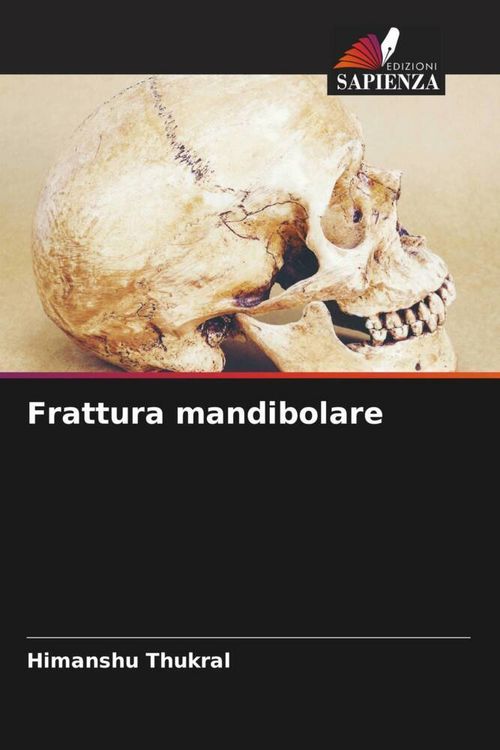 Produktbild: Frattura mandibolare