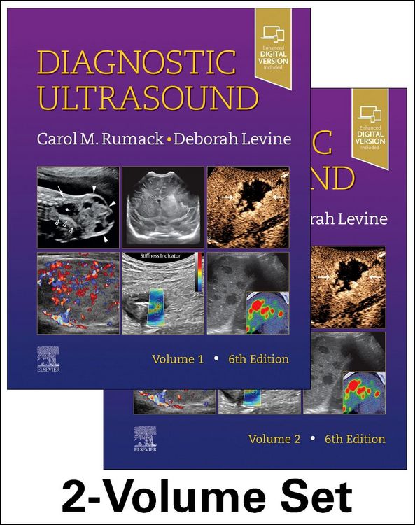 Produktbild: Diagnostic Ultrasound, 2-Volume Set