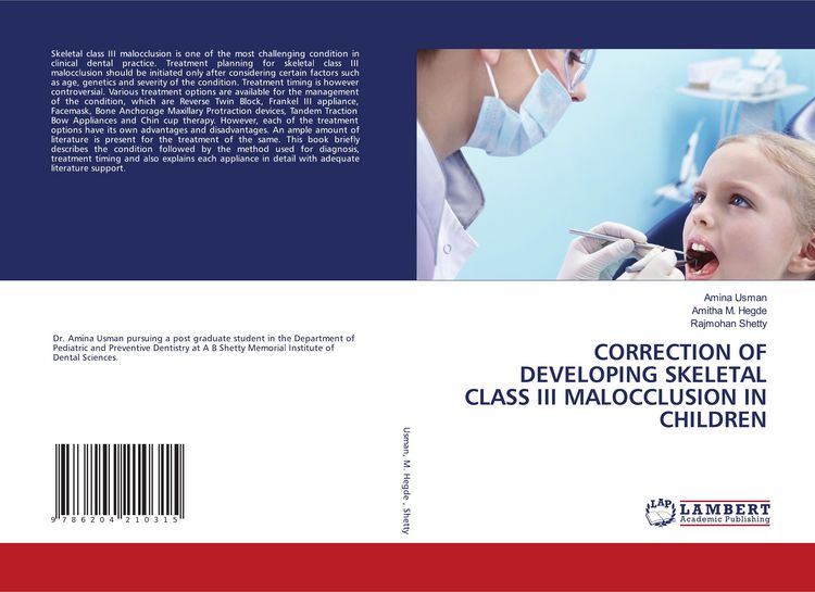 Produktbild: Correction Of Developing Skeletal Class Iii Malocclusion in Children